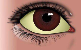 Почему белки глаз желтые