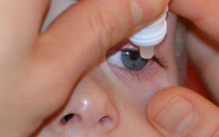 Блефароконъюнктивит глаз и его лечение