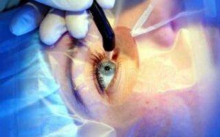 Один глаз видит хуже другого: возможные причины и особенности лечения