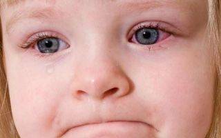 Почему у ребёнка красные глаза