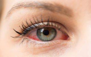 Глазные капли «айсотин»: отзывы врачей, состав и инструкция по применению