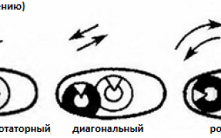 Нистагм бегающие глаза причины диагностика лечение