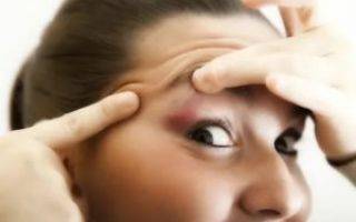 Опасно ли частое сильное моргание глазами у взрослых: причины и эффективное лечение