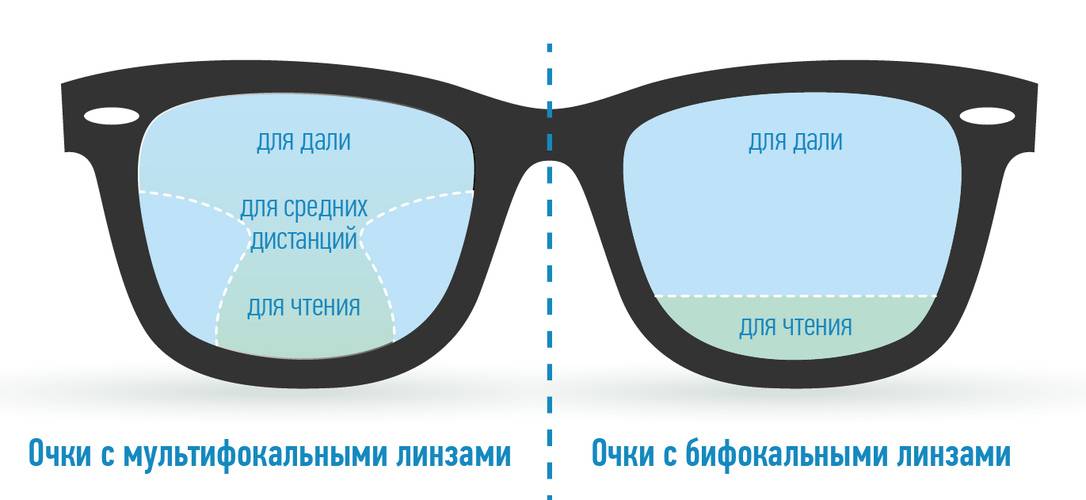 Бифокальные, мультифокальные очки плюсы и минусы их использования