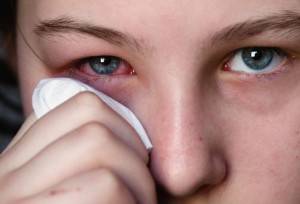 Простуда глаза: понятие, симптомы, лечение.