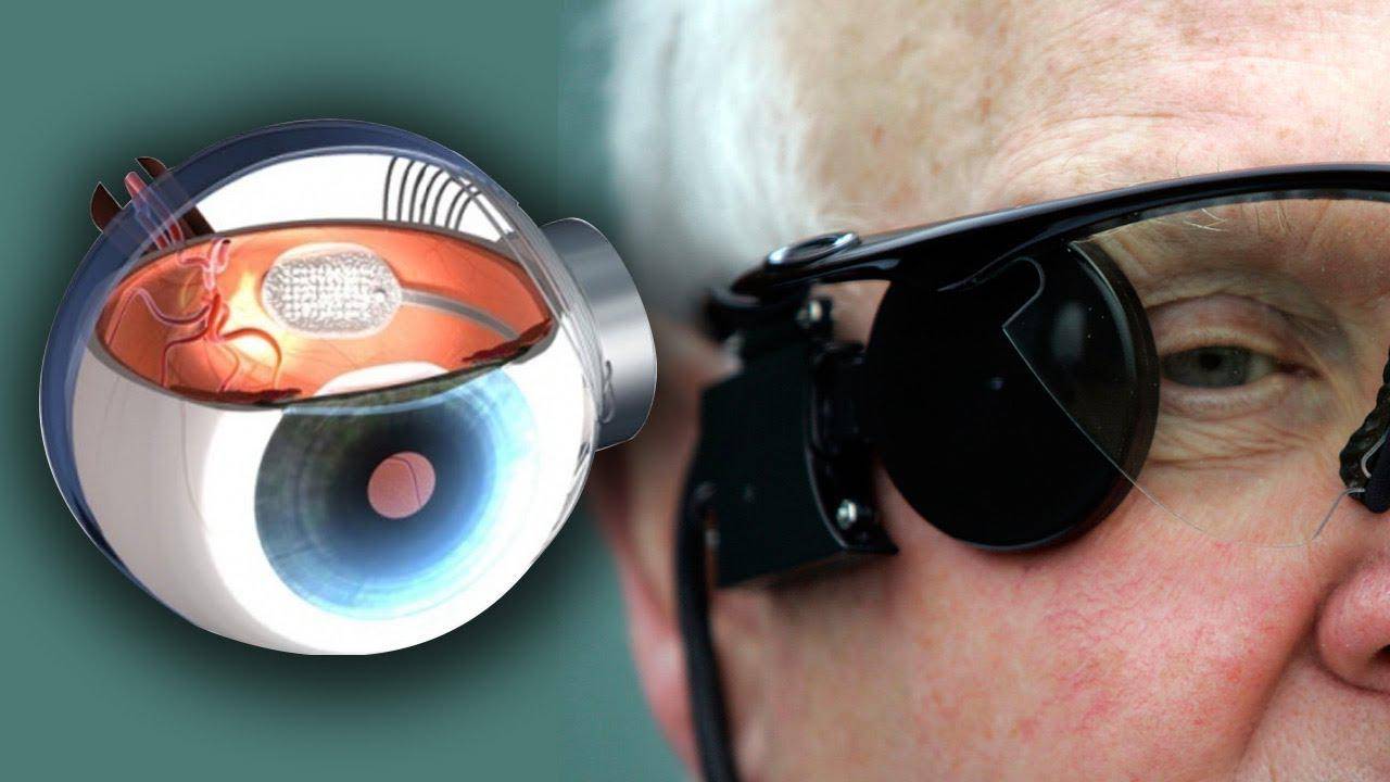 Бионический глаз – искусственная зрительная система :: syl.ru