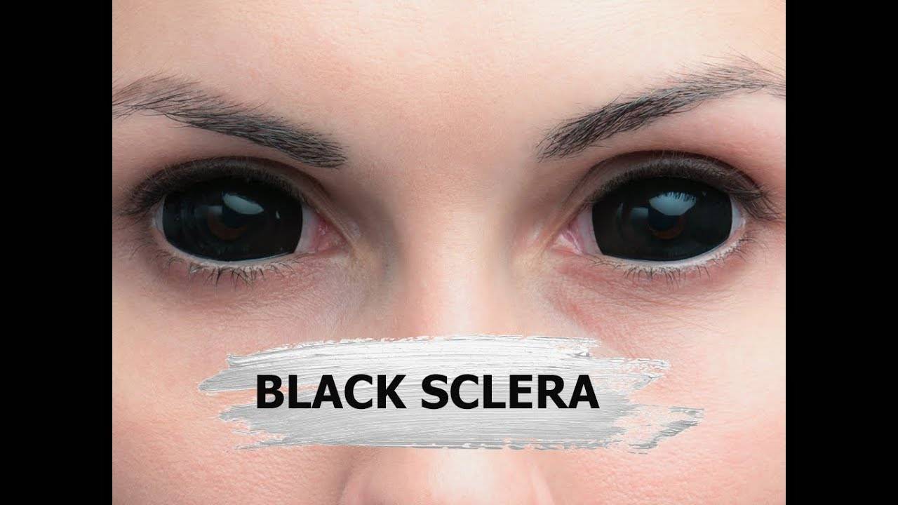 Черные линзы: как называются большие, когда полностью на весь глаз, как носить склеральные без зрачков чисто темные, есть ли контактные цветные с диоптриями, и фото