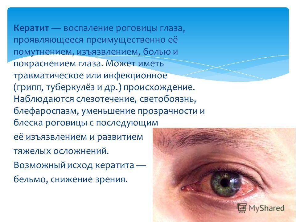 Воспаление нижнего века глаза - как снять и чем лечить в домашних условиях, если воспалился, что делать