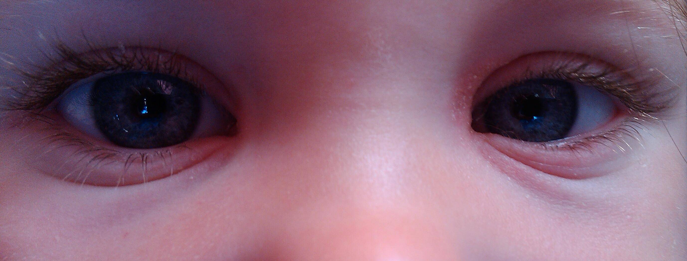 Болит уголок глаза ближе к носу, возле переносицы (внутренний или внешний): симптомы, причины, лечение боли, профилактика