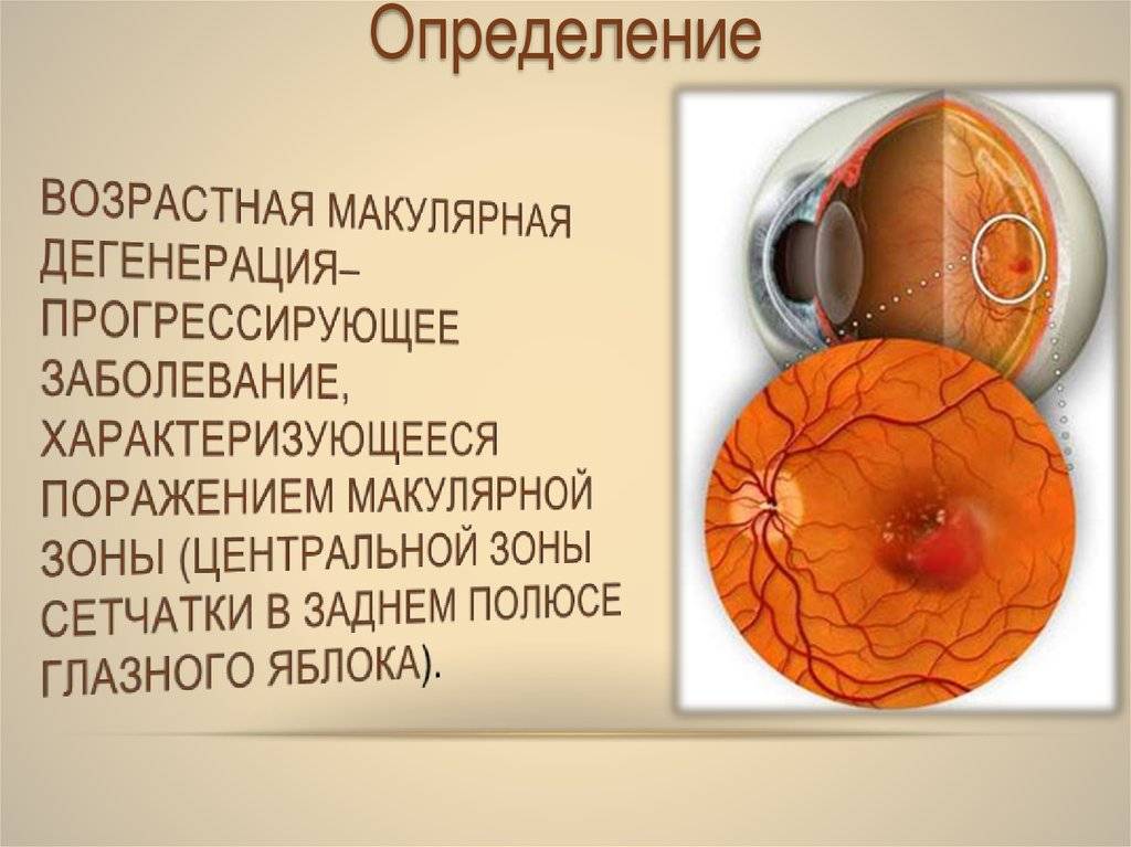Знаете ли вы: какие заболевания сетчатки выделяют в офтальмологии?