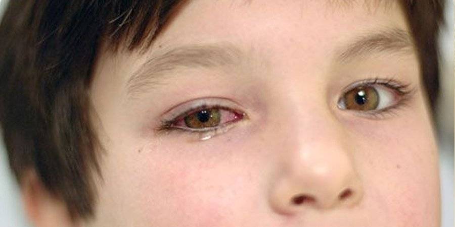 Онкология глаза: симптомы и методы лечения - "здоровое око"