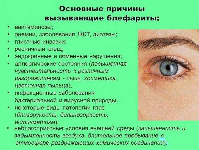Глазные болезни - симптомы и лечение заболеваний и инфекций глаз