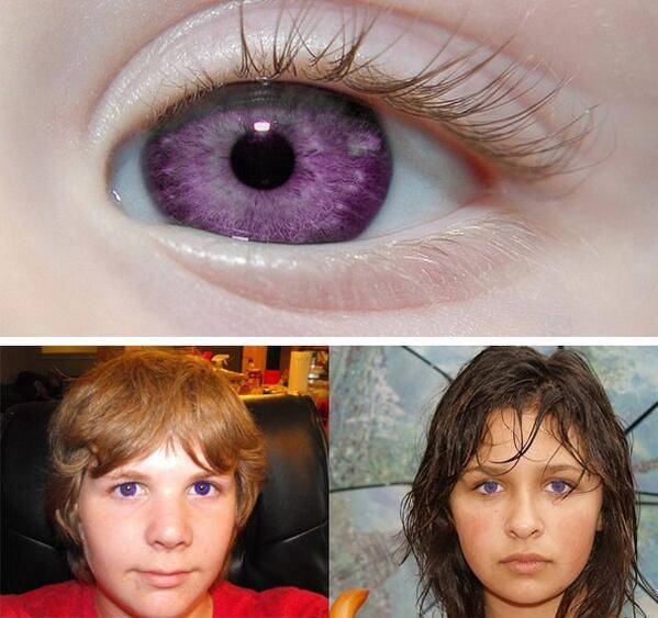Фиолетовый цвет глаз