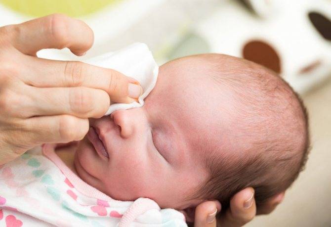 Чем обработать глаза новорожденному если гноятся - всё о грудничках