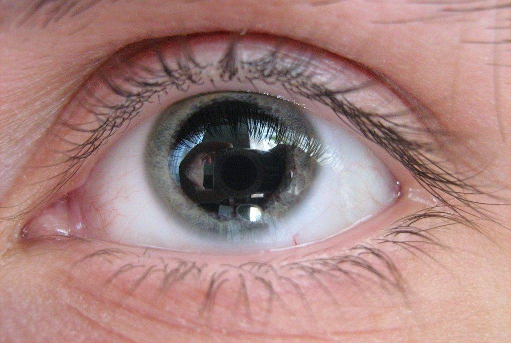 Мидриаз зрачка: причины, лечение медикаментозного и травматического мидриаза глаз