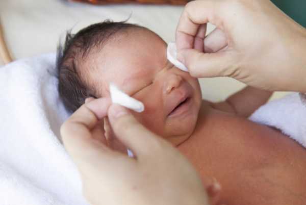 Закупорка слезного канала у новорожденных: фото, симптомы непроходимости, лечение лазером, народными средствами, операция. как делать массаж в домашних условиях, когда проходит