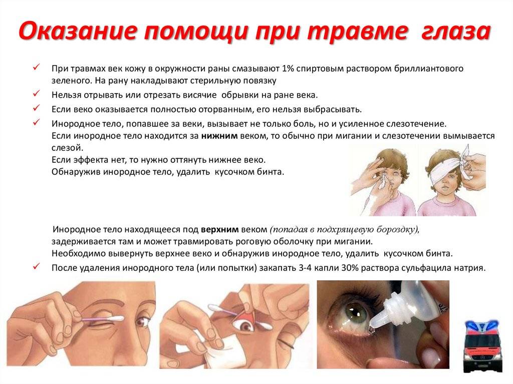 Травмы глаза: виды повреждений и методы лечения