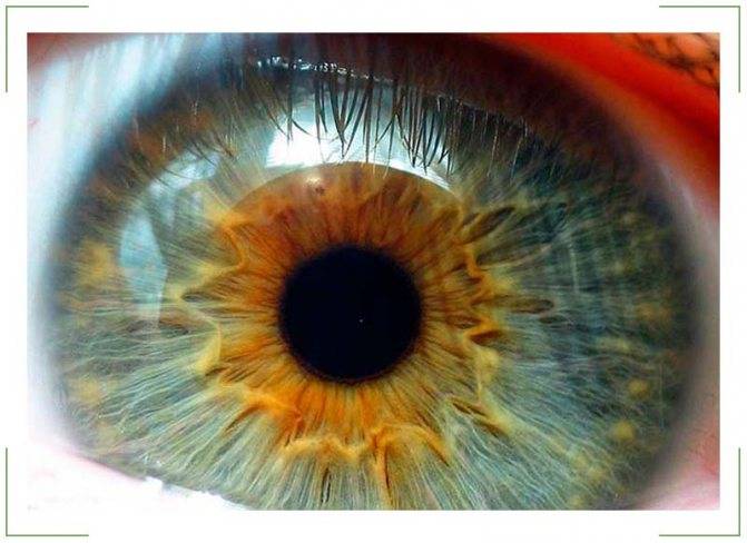 Ангиопатия сосудов сетчатки обоих глаз (ои) у ребенка: причины и лечение