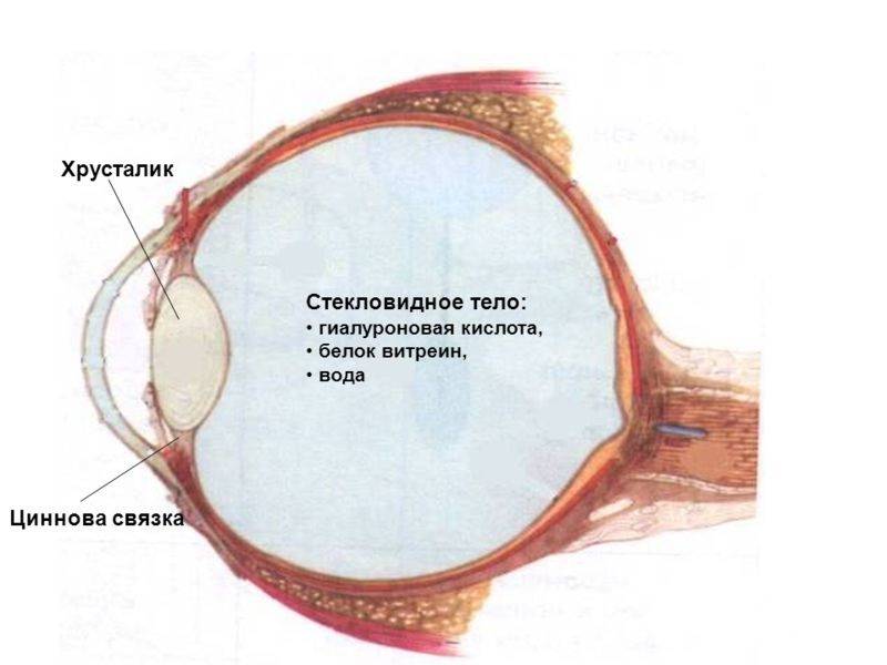 Деструкция стекловидного тела глаза