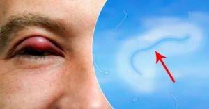 Красное пятно на белке глаза - что это, причины и лечение