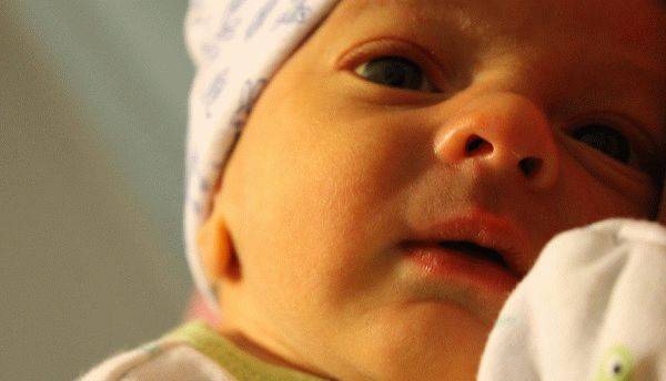 Желтые белки глаз у новорожденного: возможные причины, описание с фото, возможные проблемы и рекомендации педиатров