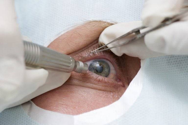 Операция при глаукоме: хирургическое антиглаукоматозное лечение