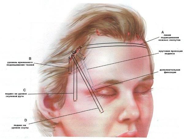 Травмы в области головы