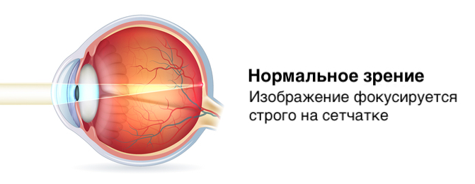 Хорошее зрение: шкала зрения, какое считается нормальным oculistic.ru
хорошее зрение: шкала зрения, какое считается нормальным