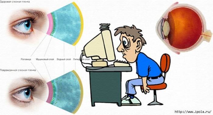 Влияние компьютера на зрение — вредит ли глазам компьютер | clean view