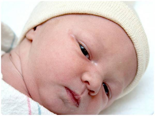 Конъюнктивит у новорожденных и детей до года: какие капли применять