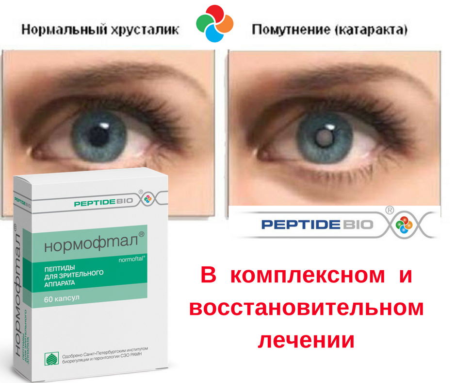Пептидные биорегуляторы препараты для глаз. Витамины для глаз для сетчатки глаза. Пептиды для глаз капли. Витамины для глаз отзывы пациентов