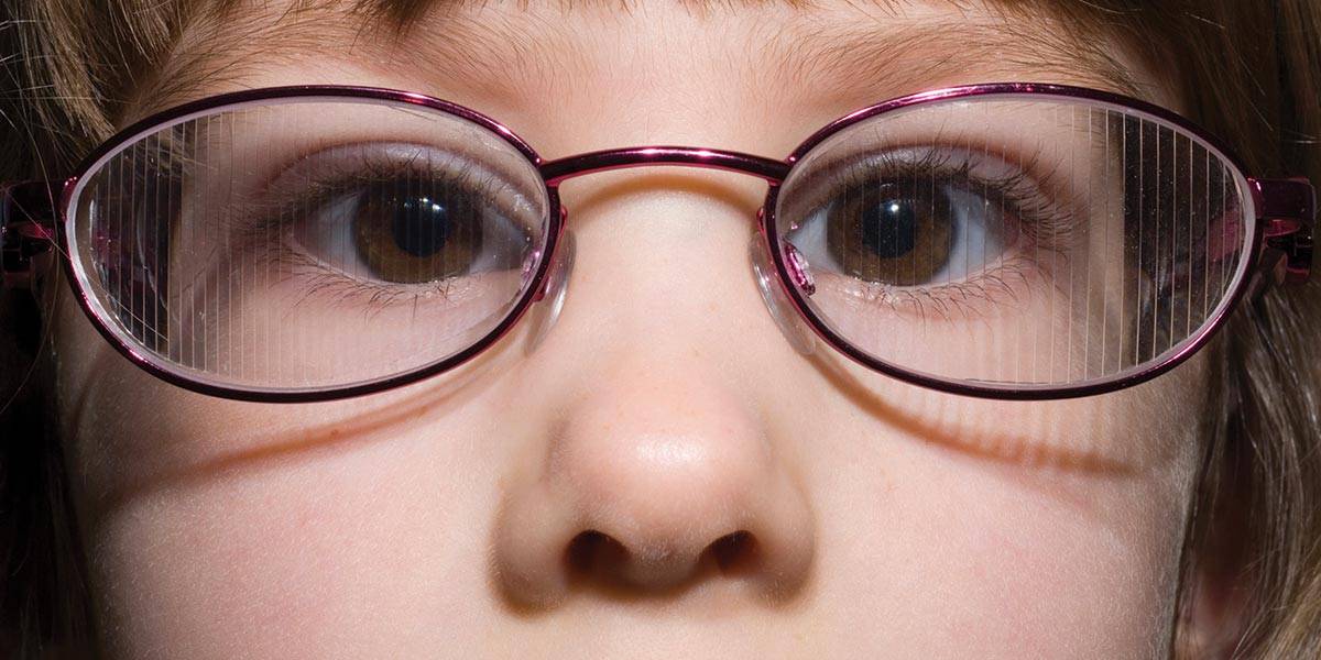 Наклейки на глаза детские от косоглазия: виды, правила выбора и применения — глаза эксперт