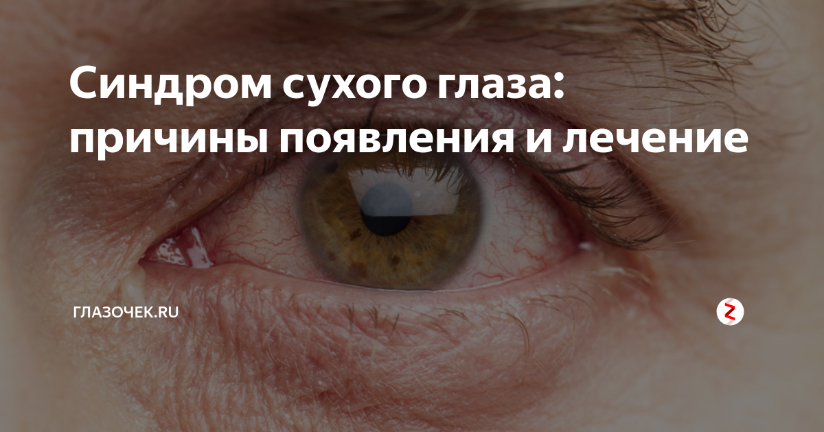 10 причин появления стеклянных глаз у человека ?