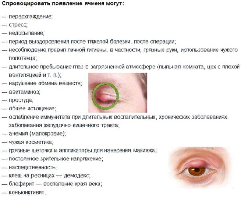 Опухло и болит верхнее веко глаза: причины, чем лечить в домашних условиях oculistic.ru
опухло и болит верхнее веко глаза: причины, чем лечить в домашних условиях