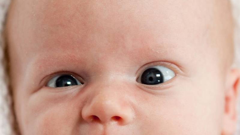 Косоглазие у новорождённых: симптомы, лечение - "здоровое око"