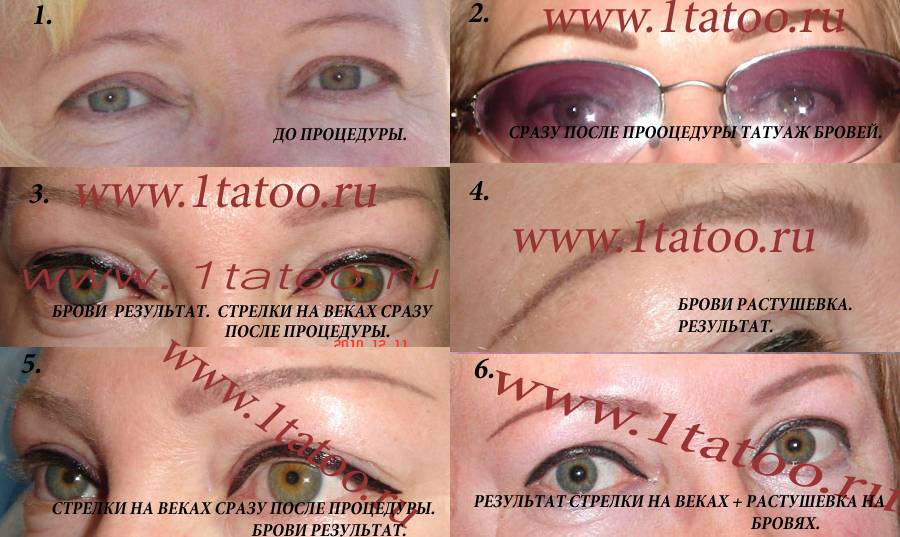 Уход за губами после процедуры татуажа: правила и что нельзя делать после перманентного макияжа
