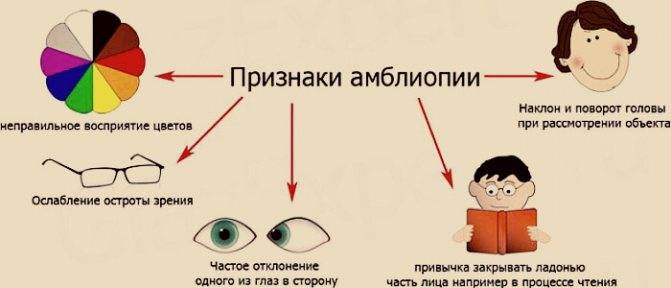 Один глаз видит хуже другого: как исправить, причины oculistic.ru
один глаз видит хуже другого: как исправить, причины