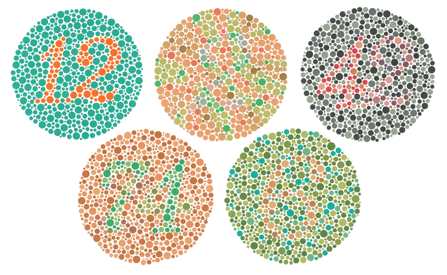Нарушение цветовосприятия, диагностика цветового зрения