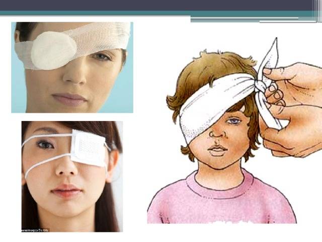 Травмы глаз: лечение в домашних условиях народными средствами при механических ушибах зрительных органов