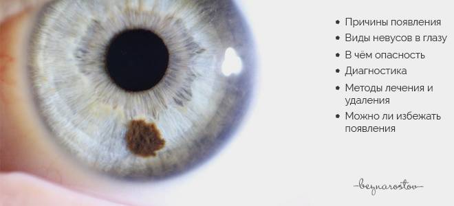Пигментный невус хориоидеи глаза | лечение глаз