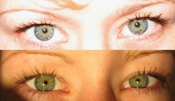 Почему меняется цвет глаз у человека? фото, причины и значение
