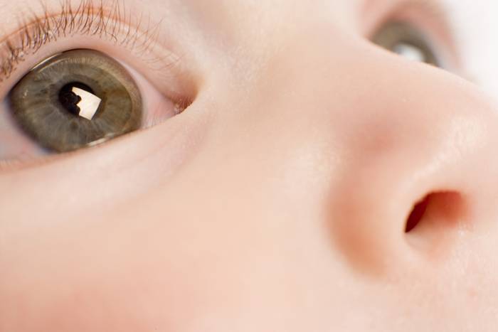 У грудничка красные глаза: причины данного явления у новорожденного ребенка (после родов) и младенца до года