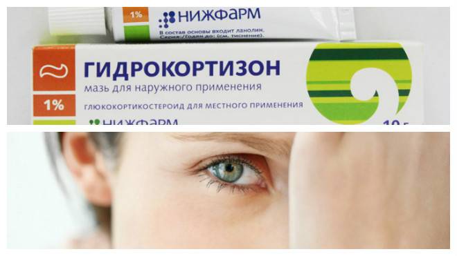 Капли в глаза от покраснения и воспаления – список недорогих, эффективных препаратов для взрослых и детей (с антибиотиком, против вирусов и аллергии)