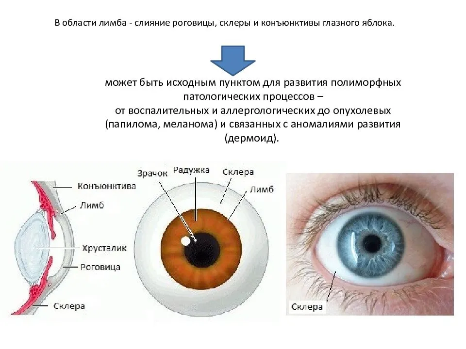 Причины инъецирования склер глаз