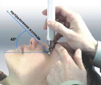 Глазное давление - норма и измерение. симптомы и лечение повышенного глазного давления в домашних условиях