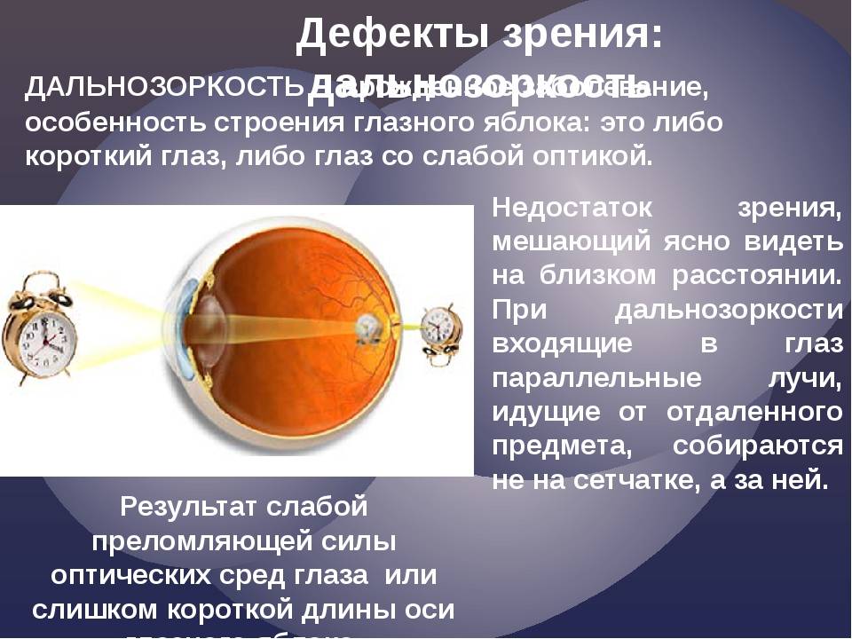 Причины нарушения зрения: сумеречного, цветового, бинокулярного, полей, степени, профилактика, виды
