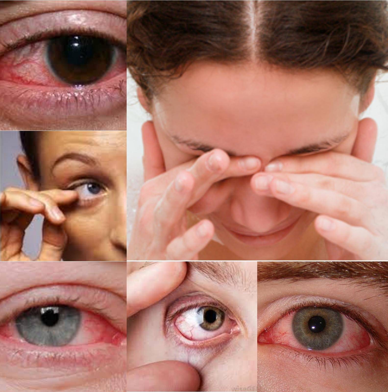 Сухость глаз: лечение народными средствами в домашних условиях у взрослых и пожилых людей, терапия синдрома сухого глаза дома