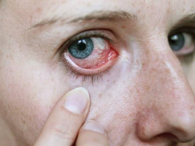 Отслоение сетчатки глаза: последствия после операции, что это такое и чем грозит