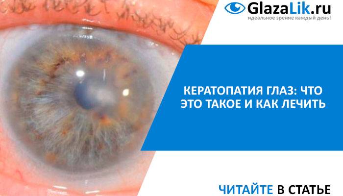 Кератопатия глаза: лечение, причины, симптомы и профилактика