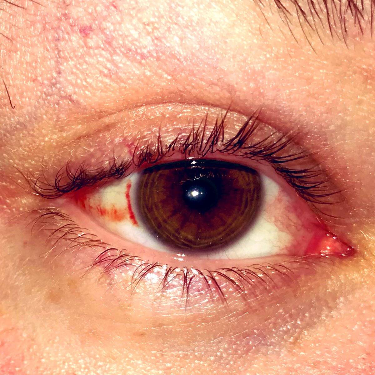 Глаза режет от компьютера: симптомы, причины и методы лечения - "здоровое око"